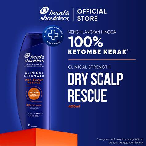 Merawat Kulit Kepala