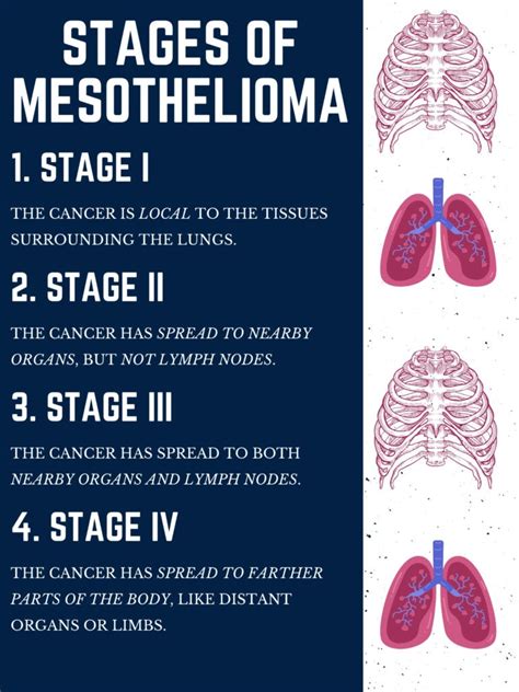 Mesothelioma Stages: How It Progresses and What to Expect
