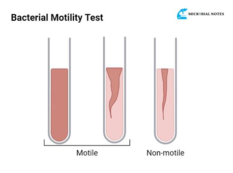 Motil vs Non-Motil