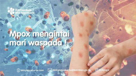 Mpox Mengintai