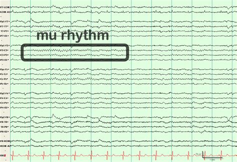 Rhythm EEG