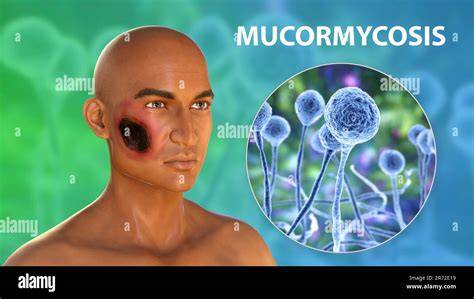 Mucor