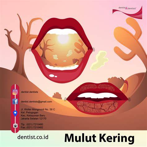 Mulut kering