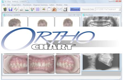 My Ortho Chart