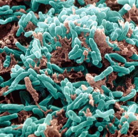 Mycobacterium tuberculosis bacteria