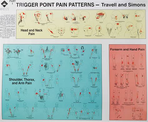 Myofascial Trigger Points Chart
