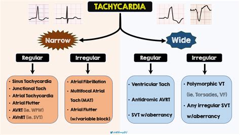 Tachycardia Medication