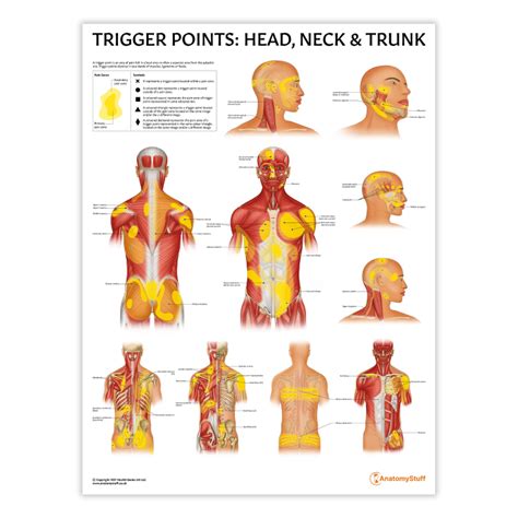 Neck Trigger Points Chart
