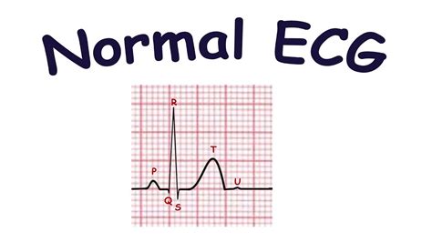 Waves EKG