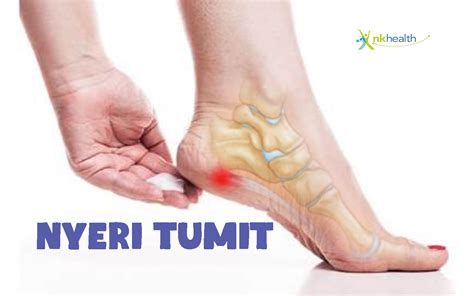 Nyeri Tumit
