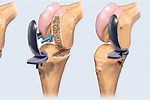 Orthopedic Surgury Knee