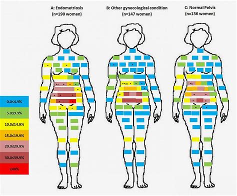 Pain Chart Body Diagram Female