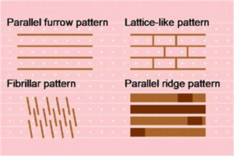Parallel Furrow Pattern Vs Parallel Ridge Pattern