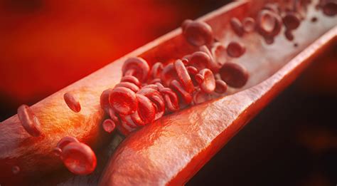Pencegahan arteriosklerosis