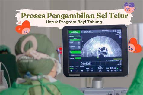 Pengambilan Sel Telur