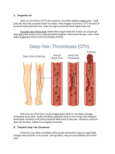 Pengobatan DVT
