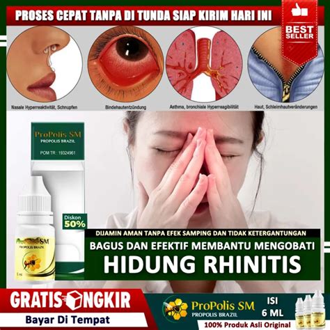 Pengobatan Rhinitis Alergi
