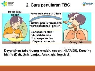 Penularan TBC melalui udara