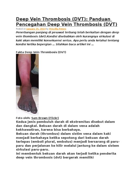Penyebab DVT
