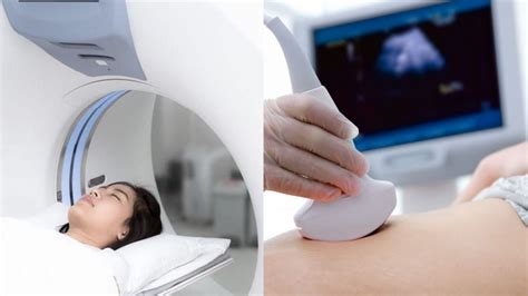 Perbedaan CT Scan dan USG