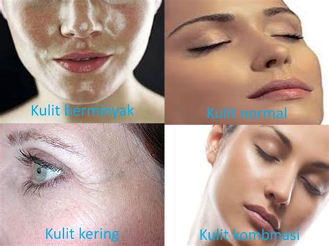 Perhatikan Jenis Kulit
