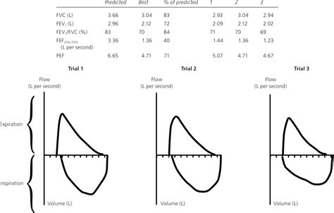 Pft Test Results Chart