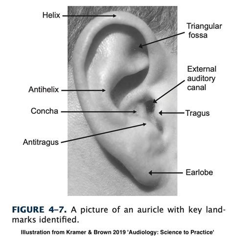 Auricle