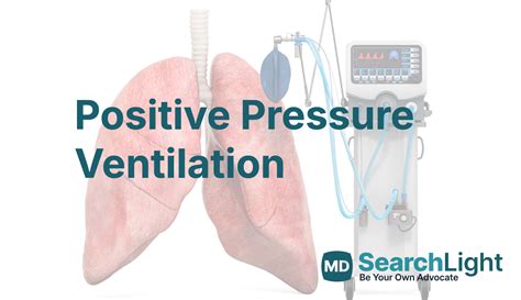 Ilustrasi Ventilasi Tekanan Positif