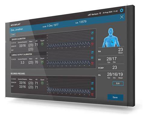 Qt in Medical Device UI