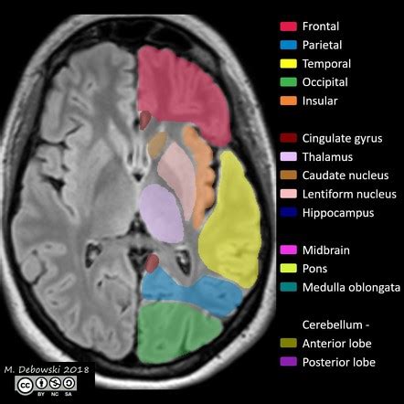 Brain Anatomy Scrollable