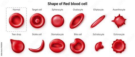 Red blood cell sizes