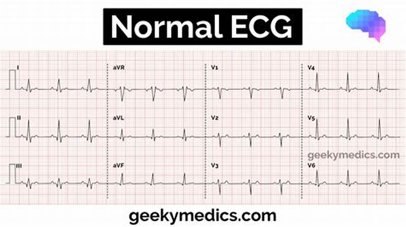 Regular Ecg Pattern