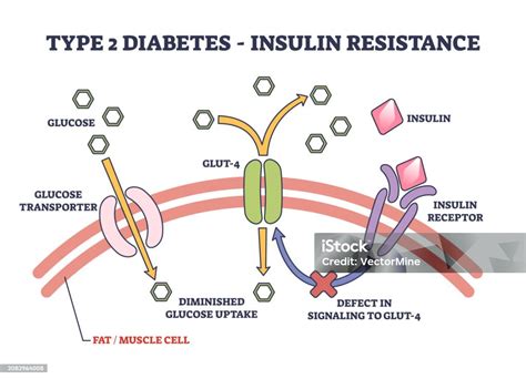Resistensi Insulin