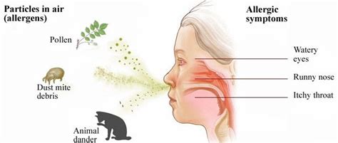 Rhinitis Alergi Musiman
