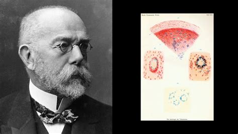 Robert Koch
