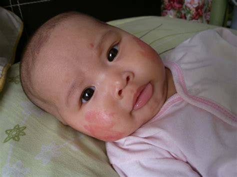 Ruam Susu