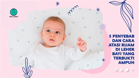 Ruam di Leher Bayi