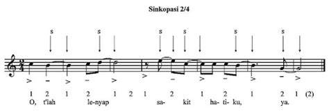 Sinkopasi dalam Musik
