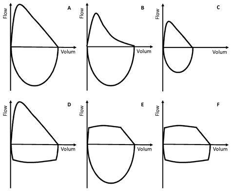 Spirometri