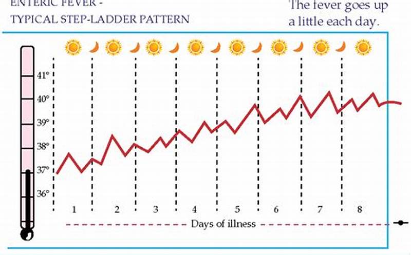 Step Ladder Pattern Of Typhoid Fever