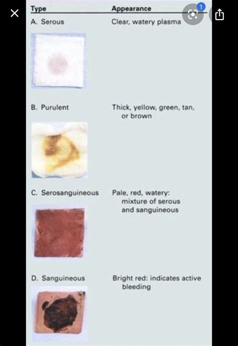 Surgical Drain Fluid Color Chart