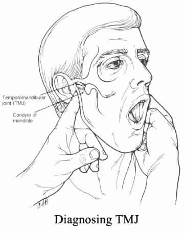 Diagnosis TMJ