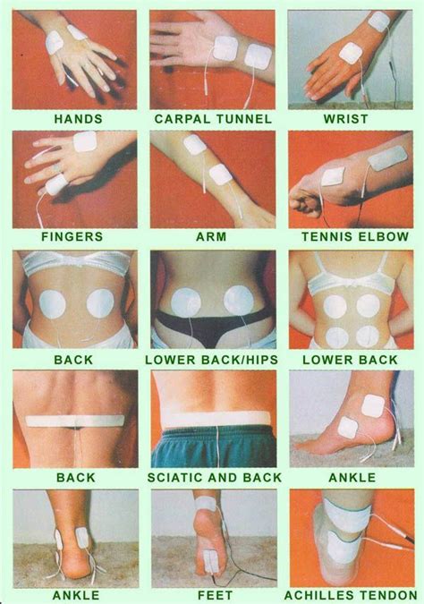 Tens Unit Pads Placement Chart