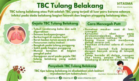 Tips Perawatan TBC Tulang