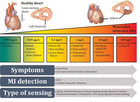 Myocardial Infarction