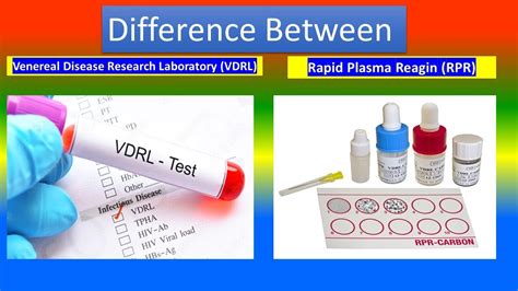 VDRL RPR laboratory test