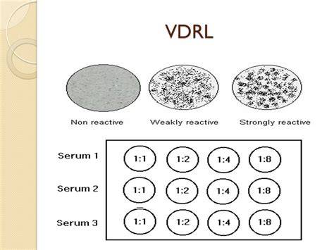 VDRL test