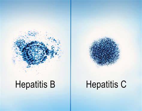 Virus Hepatitis B dan C