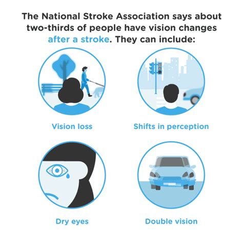 Gangguan Penglihatan Stroke