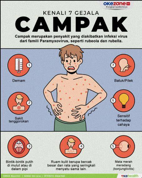 Wabah Campak AS